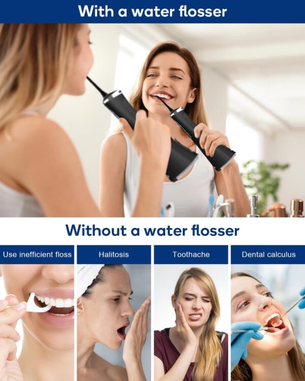 MySmile LP211 Cordless Advanced Water Flossers for Teeth - Image 2